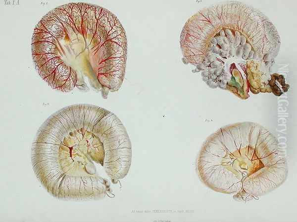 The external surface of the intestines infected with cholera, from 'Anatomie Pathologique du Cholera Morbus', by Nikolai Ivanovich Pirogov 1810-81 published in St. Petersburg, 1849 Oil Painting by Anonymous Artist