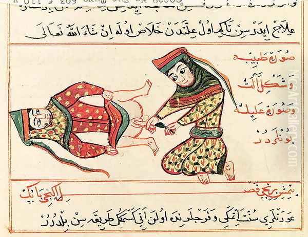 Ms Sup Turc 693 fol.110v Midwife operating on a hermaphrodite, 1466 Oil Painting by Charaf-ed-Din