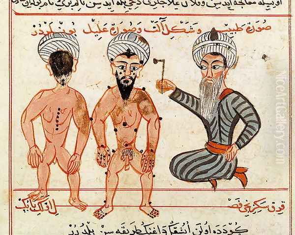 Ms Sup Turc 693 fol.46v Cauterisation of leprosy lesions, 1466 Oil Painting by Charaf-ed-Din