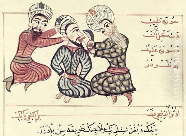 Ms Sup Turc 693 fol.76v Excision of a ranula from under the tongue, 1466 Oil Painting by Charaf-ed-Din