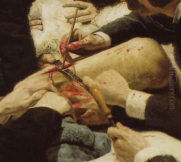 The Gross Clinic (detail) Oil Painting by Thomas Cowperthwait Eakins