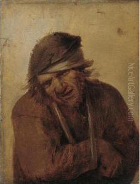 A Peasant Grimacing, His Arm In A Sling Oil Painting by Joos van Craesbeeck