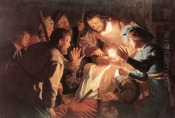 The Dentist 1622 Oil Painting by Gerrit Van Honthorst