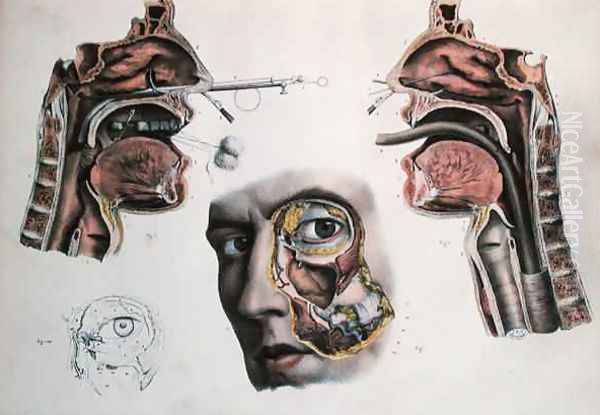 A Nasal Operation Oil Painting by Nicolas Henri Jacob