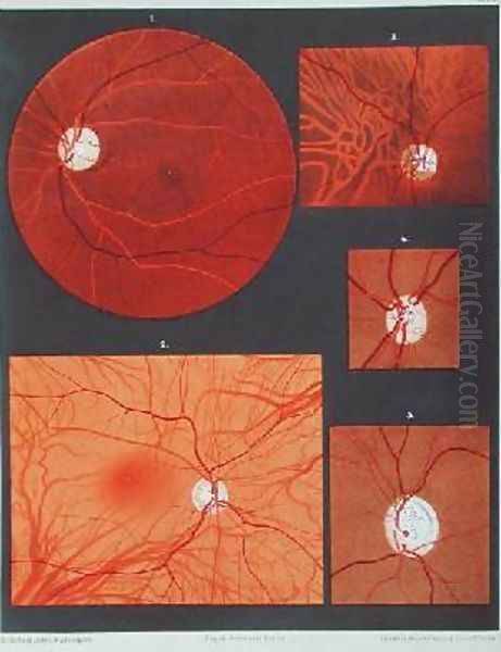 The eye seen through a microscope Oil Painting by Liebreich, Richard