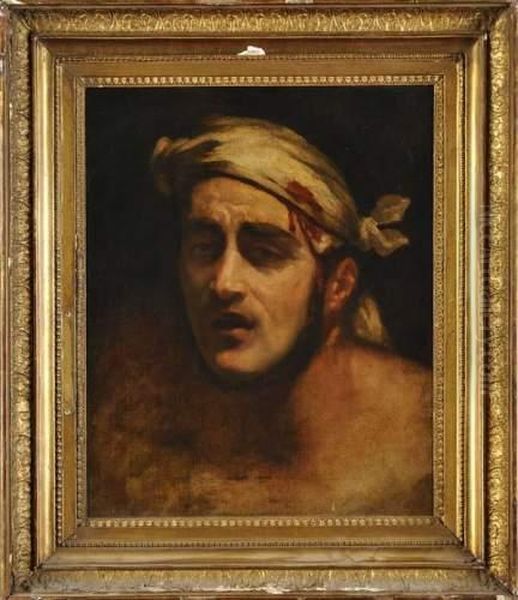 L'homme Blesse Oil Painting by Theodore Gericault