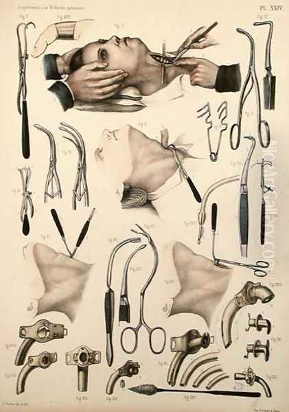 Tracheotomy operation, plate from Traite Complet de lAnatomie de lHomme by Jean-Baptiste Marc Bourgery 1797-1849 1866-67 2 Oil Painting by E. Pochet