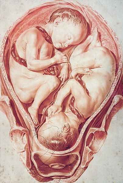 Ms Hunter 654 Plate 10 Drawing from a Set of Obstetrical Drawings for William Smellies 1697-1763 Obstetrical Tables Oil Painting by Jan van Rymsdyk