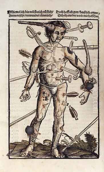 XVIIIv The Wound Man, from the Feldtbuch der Wundartzney by Hans von Gersdorff, 1517 Oil Painting by Hans or Johannes Ulrich Wechtlin