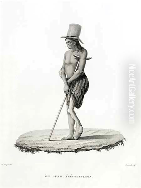 Guam: A Man with Elephantiasis, from 'Voyage Autour du Monde sur les Corvettes de L'Uranie 1817-20' Oil Painting by Jacques Etienne Victor Arago